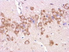 Anti-beta Amyloid (1-42) antibody used in IHC (Paraffin sections) (IHC-P). GTX60998
