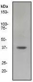 Anti-MEK6 antibody [EP558Y], C-term used in Western Blot (WB). GTX61432