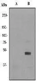 Anti-JNK (phospho Tyr185) antibody [EP1597Y] used in Western Blot (WB). GTX61742