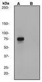Anti-Rad17 (phospho Ser645) antibody [EP1519Y] used in Western Blot (WB). GTX61991