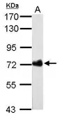 Anti-Helicobacter pylori urease B antibody [GT962] used in Western Blot (WB). GTX627291
