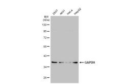 Anti-GAPDH antibody [GT239] (HRP) used in Western Blot (WB). GTX627408-01