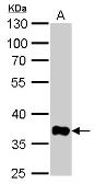 Anti-GAPDH antibody [GT239] used in Western Blot (WB). GTX627408