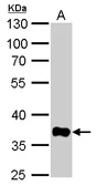 Anti-GAPDH antibody [GT239] used in Western Blot (WB). GTX627408