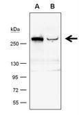 Anti-TET1 antibody [GT1462] used in Western Blot (WB). GTX627420