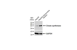 Anti-Citrate synthase antibody [GT1761] used in Western Blot (WB). GTX628143