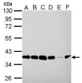 Anti-PEX19 antibody [GT554] used in Western Blot (WB). GTX628212