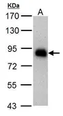 Anti-HNF1 alpha antibody [GT4110] used in Western Blot (WB). GTX628240