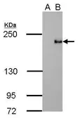 Anti-TET3 antibody [GT334] used in Western Blot (WB). GTX628257