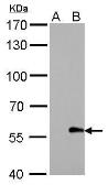 Anti-Myc tag antibody [GT0002] (HRP) used in Western Blot (WB). GTX628259-01