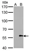 Anti-Myc tag antibody [GT0002] (HRP) used in Western Blot (WB). GTX628259-01