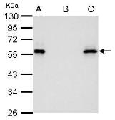 Anti-Myc tag antibody [GT0002] used in Immunoprecipitation (IP). GTX628259