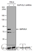 Anti-SUPV3L1 antibody [GT244] used in Western Blot (WB). GTX628260