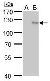Anti Hif1 Alpha Antibody Gt10211 Gtx628480 Genetex