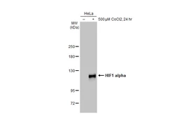 Anti-HIF1 alpha antibody [GT10211] used in Western Blot (WB). GTX628480