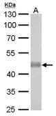 Anti-IDH2 antibody [GT673] used in Western Blot (WB). GTX628487