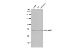 Anti-PRMT5 antibody [GT3610] used in Western Blot (WB). GTX628488