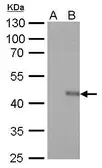 Anti-V5 tag antibody [GT1071] (HRP) used in Western Blot (WB). GTX628529-01
