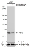 Anti-CBS antibody [GT519] used in Western Blot (WB). GTX628777
