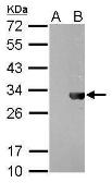 Anti-HSV tag antibody [GT212] used in Western Blot (WB). GTX628790