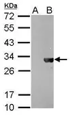 Anti-HSV tag antibody [GT212] used in Western Blot (WB). GTX628790