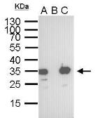 Anti-S Tag antibody [GT247] used in Immunoprecipitation (IP). GTX628791