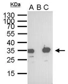 Anti-S Tag antibody [GT247] used in Immunoprecipitation (IP). GTX628791
