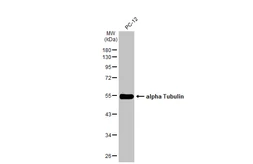 Anti-alpha Tubulin antibody [GT114] (HRP) used in Western Blot (WB). GTX628802-01