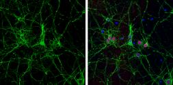Anti-alpha Tubulin antibody [GT114] used in Immunocytochemistry/ Immunofluorescence (ICC/IF). GTX628802