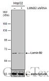 Anti-Lamin B2 antibody [GT144] used in Western Blot (WB). GTX628803