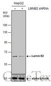 Anti-Lamin B2 antibody [GT144] used in Western Blot (WB). GTX628803