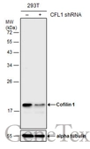 Anti-Cofilin 1 antibody [GT567] used in Western Blot (WB). GTX628804