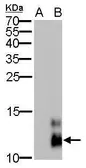 Anti-Pancreatic Polypeptide antibody [GT6512] used in Western Blot (WB). GTX628832