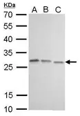 Anti-HMGB1 antibody [GT348] used in Western Blot (WB). GTX628835