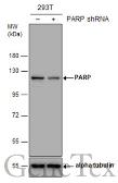 Anti-PARP antibody [GT6212] used in Western Blot (WB). GTX628836