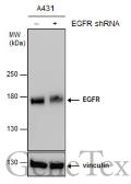 Anti-EGFR antibody [GT461] used in Western Blot (WB). GTX628888