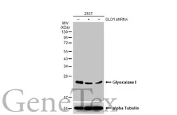 Anti-Glyoxalase I antibody [GT266] used in Western Blot (WB). GTX628889