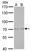 Anti-SAMHD1 antibody [GT954] used in Western Blot (WB). GTX628891