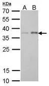 Anti-PEX19 antibody [GT533] used in Western Blot (WB). GTX628892