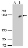 Anti-TET3 antibody [GT859] used in Western Blot (WB). GTX628893
