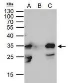 Anti-GFP antibody [GT7312] used in Immunoprecipitation (IP). GTX628894