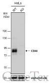 Anti-CD44 antibody [GT462] used in Western Blot (WB). GTX628895