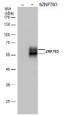 Anti-ZNF703 antibody [GT264] used in Western Blot (WB). GTX628896