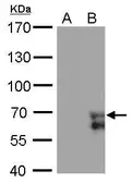 Anti-ZNF703 antibody [GT372] used in Western Blot (WB). GTX628897