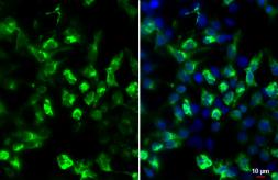 Anti-HA tag antibody [GT4810] used in Immunocytochemistry/ Immunofluorescence (ICC/IF). GTX628902