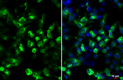 Anti-HA tag antibody [GT4810] used in Immunocytochemistry/ Immunofluorescence (ICC/IF). GTX628902