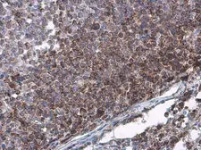 Anti-Bcl-2 antibody [GT576] used in IHC (Paraffin sections) (IHC-P). GTX628904