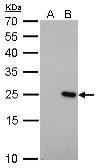 Anti-Bcl-2 antibody [GT576] used in Western Blot (WB). GTX628904