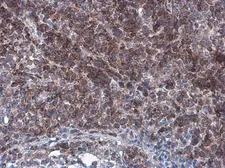 Anti-Bcl-2 antibody [GT11210] used in IHC (Paraffin sections) (IHC-P). GTX628905