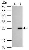 Anti-Bcl-2 antibody [GT11210] used in Western Blot (WB). GTX628905